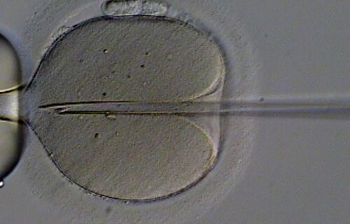 Mulheres que não possuem mais óvulos também podem engravidar por fertilização in vitro