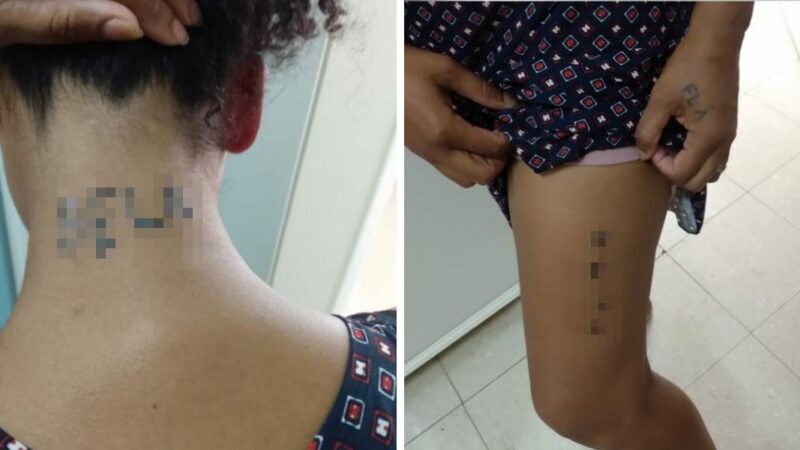 Vítima de agressão, mulher diz ter sido obrigada a tatuar nome do marido pelo corpo