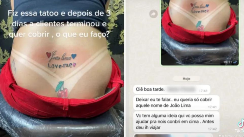 Mulher tatua nome do namorado, termina três dias depois e pede ajuda ao tatuador para remover