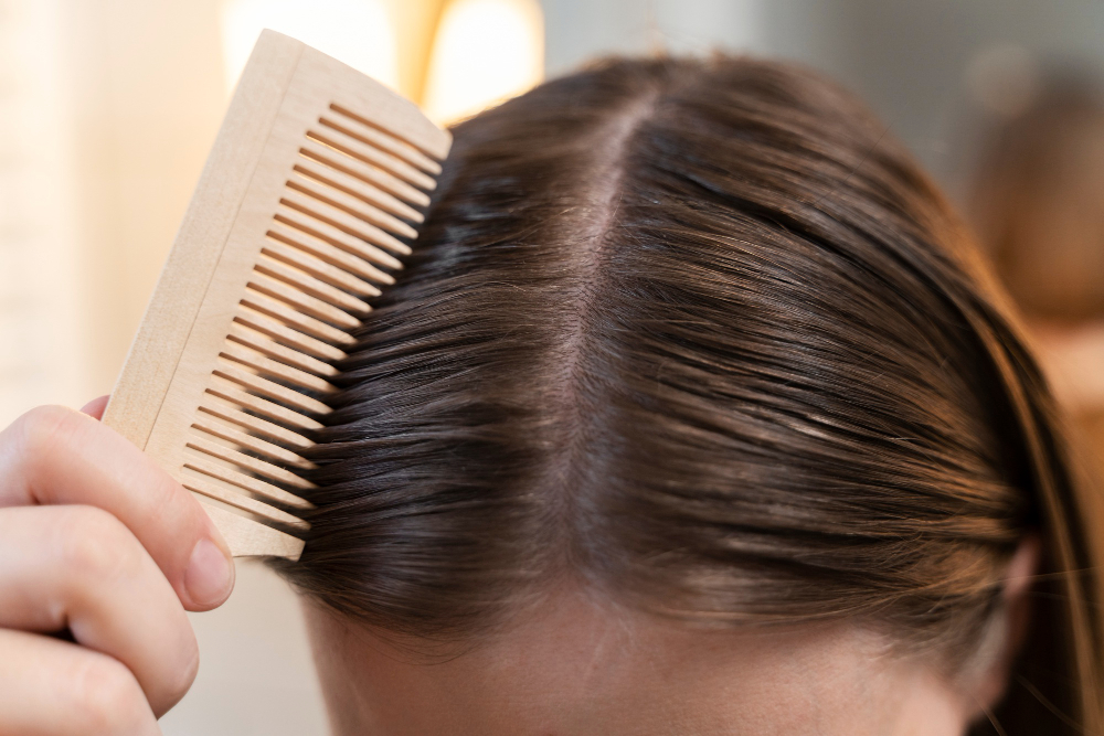 Quem tem caspa pode lavar o cabelo todos os dias? Especialista tira as dúvidas