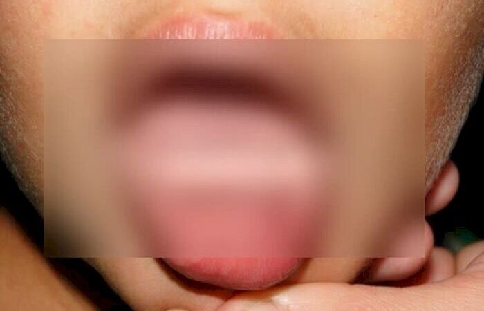 Mãe acusa professora de bater na boca do filho em MS; caso é investigado