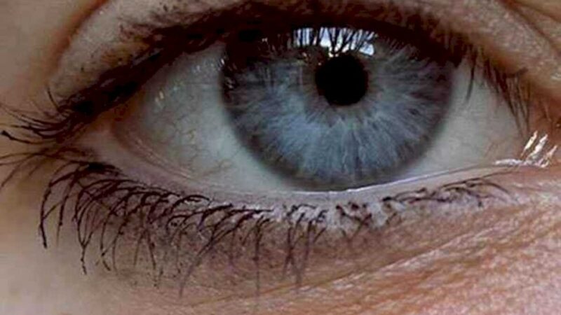 Procedimento para mudar cor dos olhos não é recomendado por médicos brasileiros