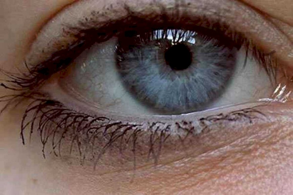 Procedimento para mudar cor dos olhos não é recomendado por médicos brasileiros