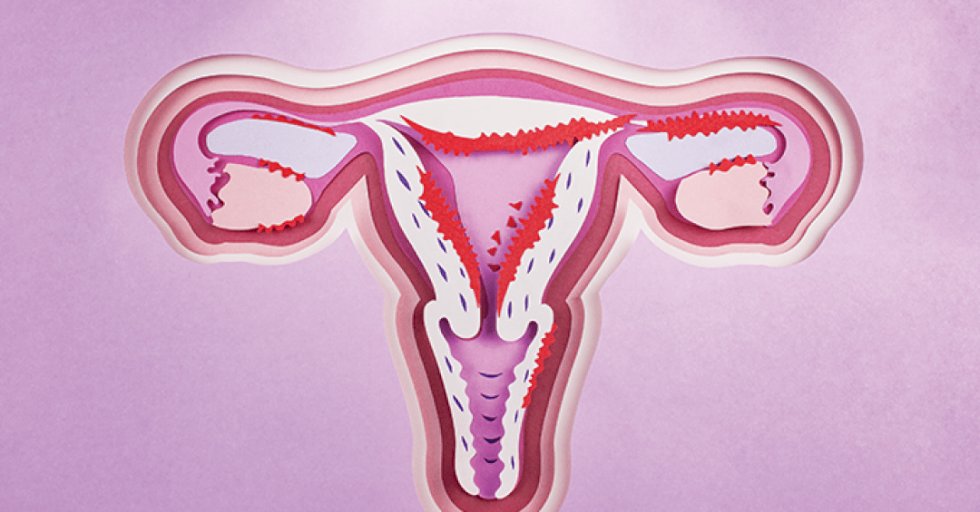 Câncer de endométrio tem nova opção terapêutica após 20 anos sem inovação