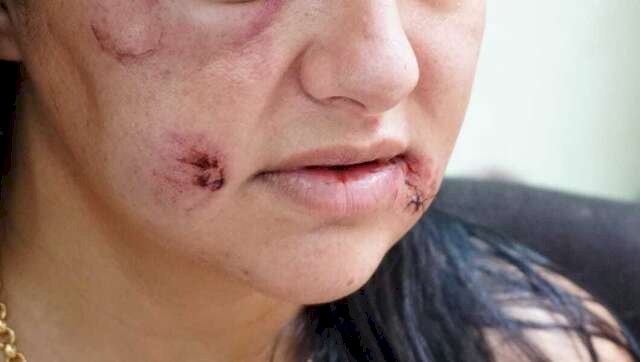 MS lidera taxas de feminicídio e estupro no País
