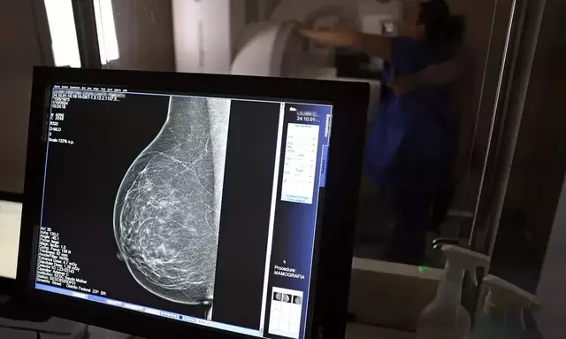 Tratamento oral contra câncer de mama avançado é aprovado no Brasil